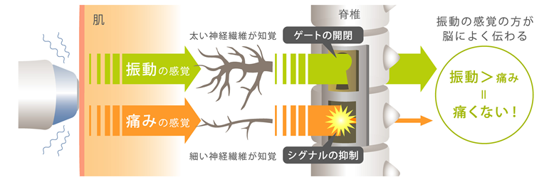 サーマクールCPTの仕組み
